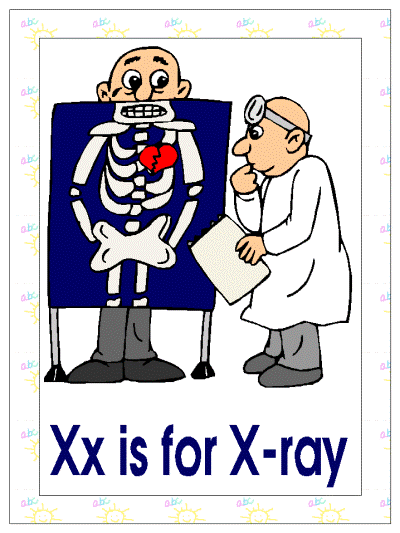 letter x is for x-ray alphabet poster